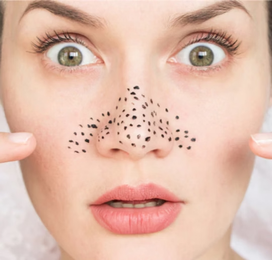 pores