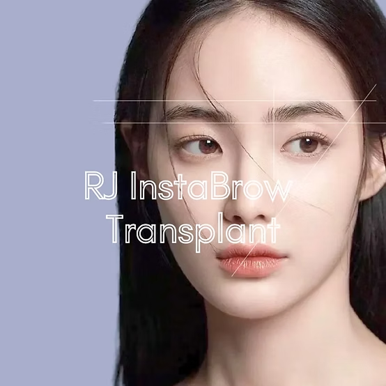 brow-ransplant