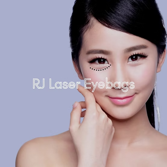 laser-eyebags