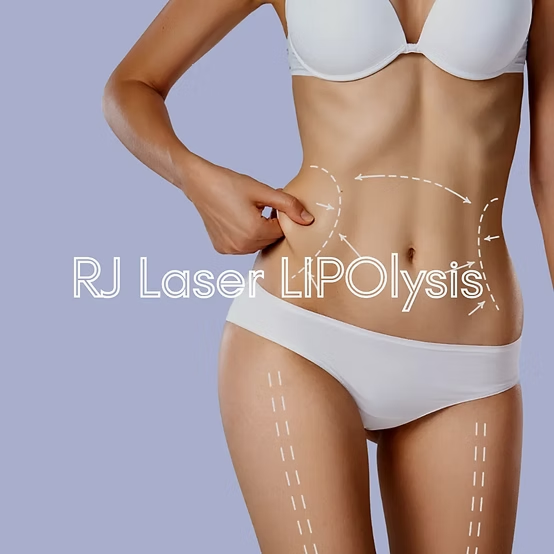 laser-lipolysis